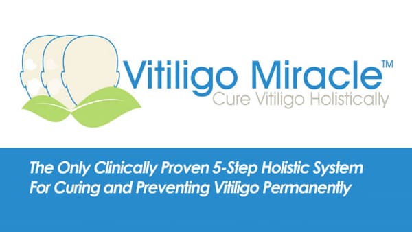 Vitiligo Miracle PDF Download
